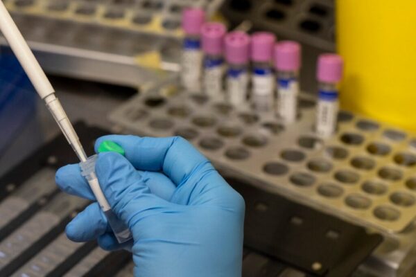 A medical laboratory technician conducts an experiment.